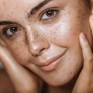 "Close-up of a lady with a charming array of freckles and healthy, radiant skin."
